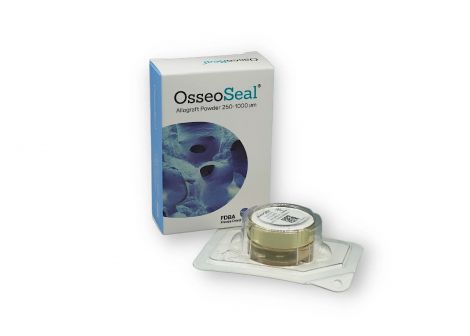 OsseoSeal Allograft Cortical/Cancellous (50/50) Powder, 250-1000um:2.5cc, 5cc