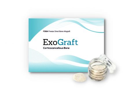 Allograft Cortical/Cancellous, 250-1000um: 1cc